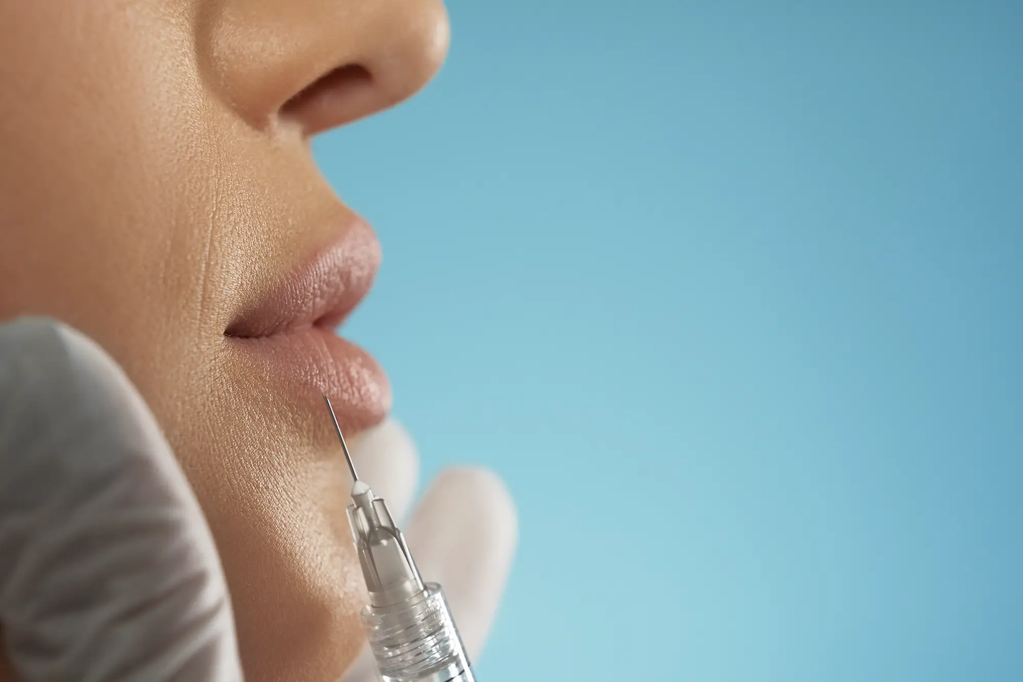 Antalya dudak dolgusu uygulaması Liberty Medikal Klinik